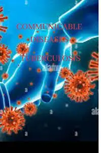 Communicable Diseases.: Tuberculosis