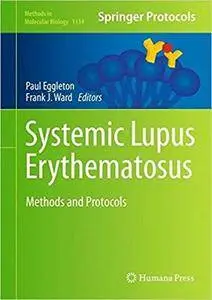 Systemic Lupus Erythematosus: Methods and Protocols (Repost)