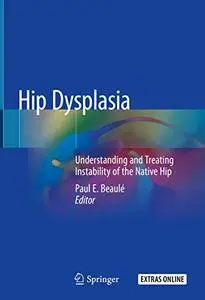 Hip Dysplasia: Understanding and Treating Instability of the Native Hip (Repost)