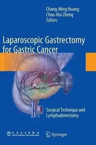 Laparoscopic Gastrectomy for Gastric Cancer: Surgical Technique and Lymphadenectomy (Repost)