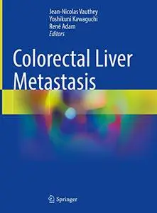 Colorectal Liver Metastasis