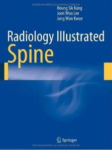 Radiology Illustrated: Spine [Repost]