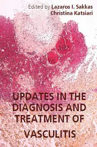 "Updates in the Diagnosis and Treatment of Vasculitis" ed. by Lazaros I. Sakkas and Christina Katsiari