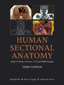 Human Sectional Anatomy: Atlas of Body Sections, CT and MRI Images (3rd Edition)