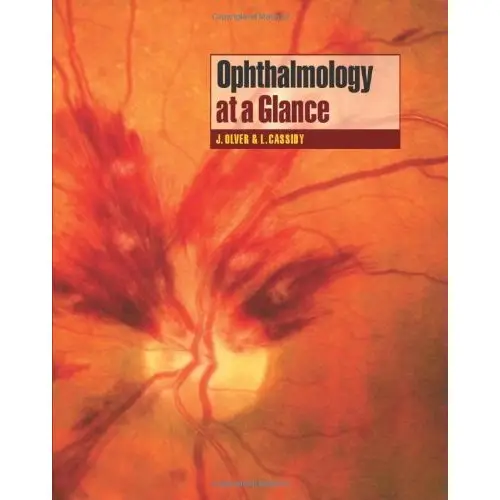 Ophthalmology at a Glance