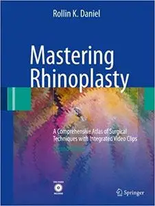 Mastering Rhinoplasty: A Comprehensive Atlas of Surgical Techniques with Integrated Video Clips (Repost)