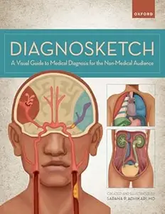 Diagnosketch: A Visual Guide to Medical Diagnosis for the Non-Medical Audience (Repost)