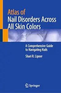 Atlas of Nail Disorders Across All Skin Colors