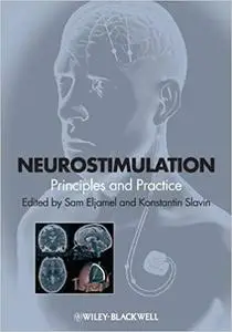 Neurostimulation: Principles and Practice