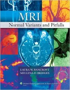 MRI Normal Variants and Pitfalls (repost)