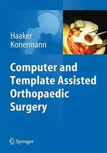 Computer and Template Assisted Orthopedic Surgery (Repost)