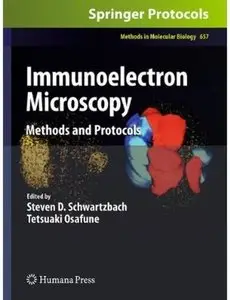 Immunoelectron Microscopy: Methods and Protocols