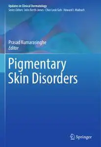 Pigmentary Skin Disorders