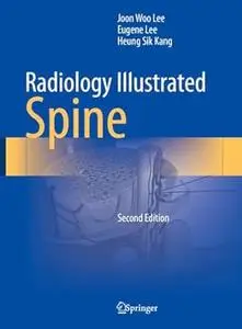 Radiology Illustrated: Spine (2nd Edition)