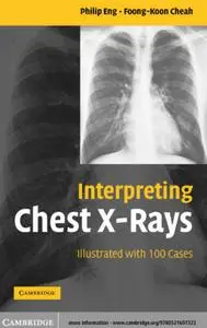 Interpreting Chest X-Rays: Illustrated with 100 Cases