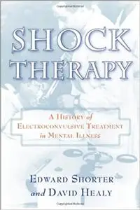 Shock Therapy: A History of Electroconvulsive Treatment in Mental Illness