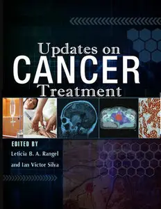 "Updates on Cancer Treatment" ed. by Leticia B. A. Rangel and Ian Victor Silva