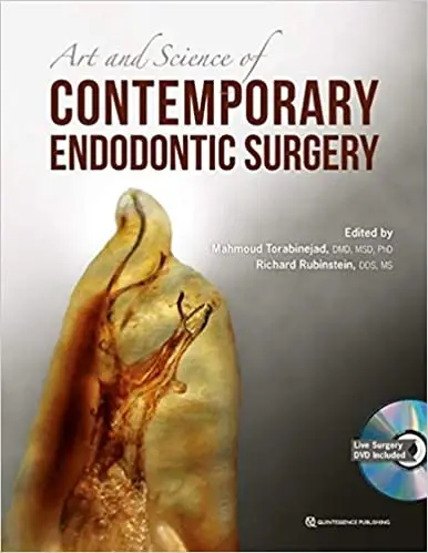 The Art and Science of Contemporary Surgical Endodontics