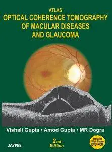 Atlas Optical Coherence Tomography of Macular Diseases and Glaucoma
