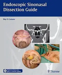 Endoscopic Sinonasal Dissection Guide