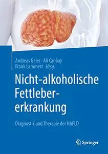 Nicht-alkoholische Fettlebererkrankung: Diagnostik und Therapie der NAFLD