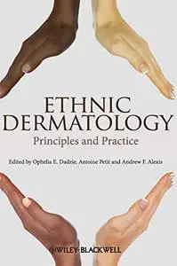 Ethnic Dermatology: Principles and Practice