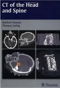 CT of the Head and Spine [Repost]