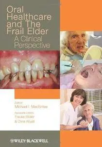 Oral Healthcare and the Frail Elder: A Clinical Perspective (Repost)