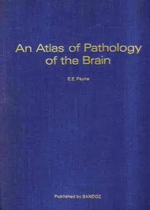 An Atlas of Pathology of the Brain by E. E. Payne