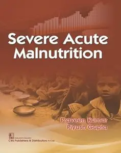 Severe Acute Malnutrition