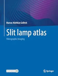 Slit lamp atlas: Videographic Imaging