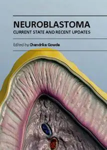 "Neuroblastoma: Current State and Recent Updates" ed. by Chandrika Gowda