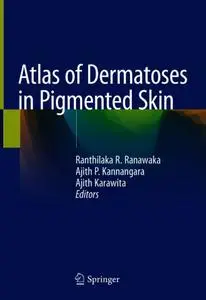 Atlas of Dermatoses in Pigmented Skin (Repost)