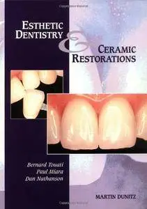 Esthetic Dentistry and Ceramic Restorations