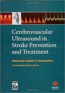 Cerebrovascular Ultrasound in Stroke Prevention and Treatment (Repost)