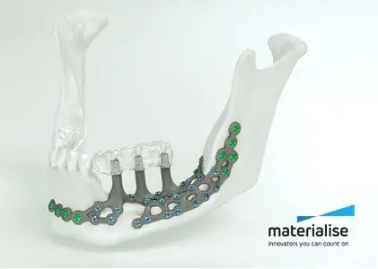 Materialise ProPlan CMF 3.0.1