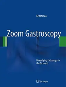 Zoom Gastroscopy: Magnifying Endoscopy in the Stomach