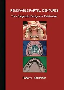 Removable Partial Dentures: Their Diagnosis, Design and Fabrication