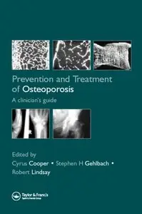 Prevention and Treatment of Osteoporosis in the High-Risk Patient