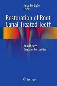 Restoration of Root Canal-Treated Teeth: An Adhesive Dentistry Perspective