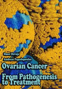 "Ovarian Cancer From Pathogenesis to Treatment" ed. by Omer Devaja, Andreas Papadopoulos
