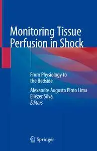 Monitoring Tissue Perfusion in Shock: From Physiology to the Bedside (Repost)