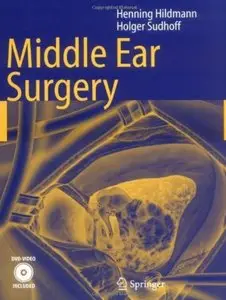 Middle Ear Surgery