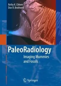 Paleoradiology: Imaging Mummies and Fossils 