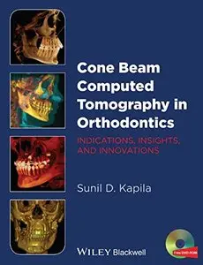 Cone Beam Computed Tomography in Orthodontics: Indications, Insights, and Innovations (repost)
