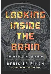 Looking Inside the Brain: The Power of Neuroimaging [Repost]