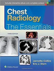 Chest Radiology: The Essentials, 3rd edition