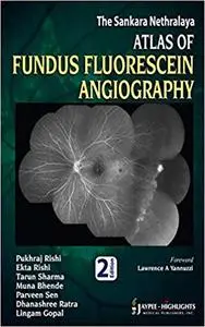 The Sankara Nethralaya Atlas of Fundus Fluorescein Angiography