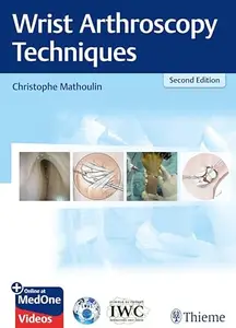 Wrist Arthroscopy Techniques (Repost)