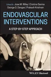 Endovascular Interventions: A Step-by-Step Approach